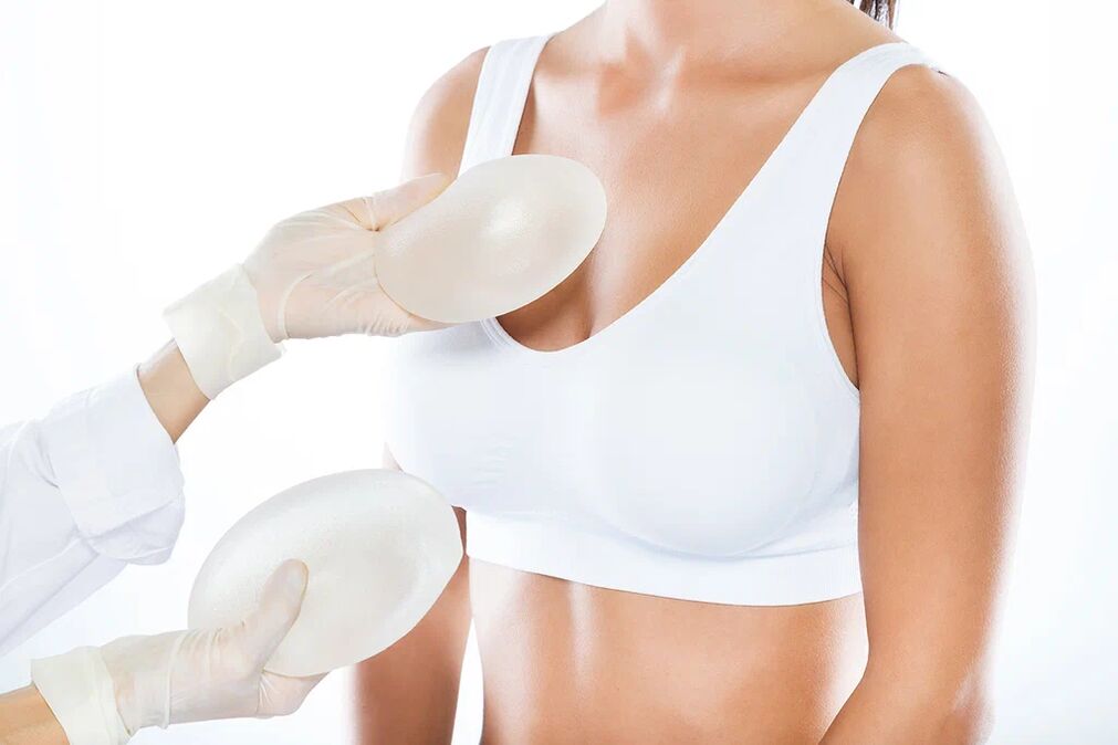 Elegir implantes antes de la cirugía de aumento de senos